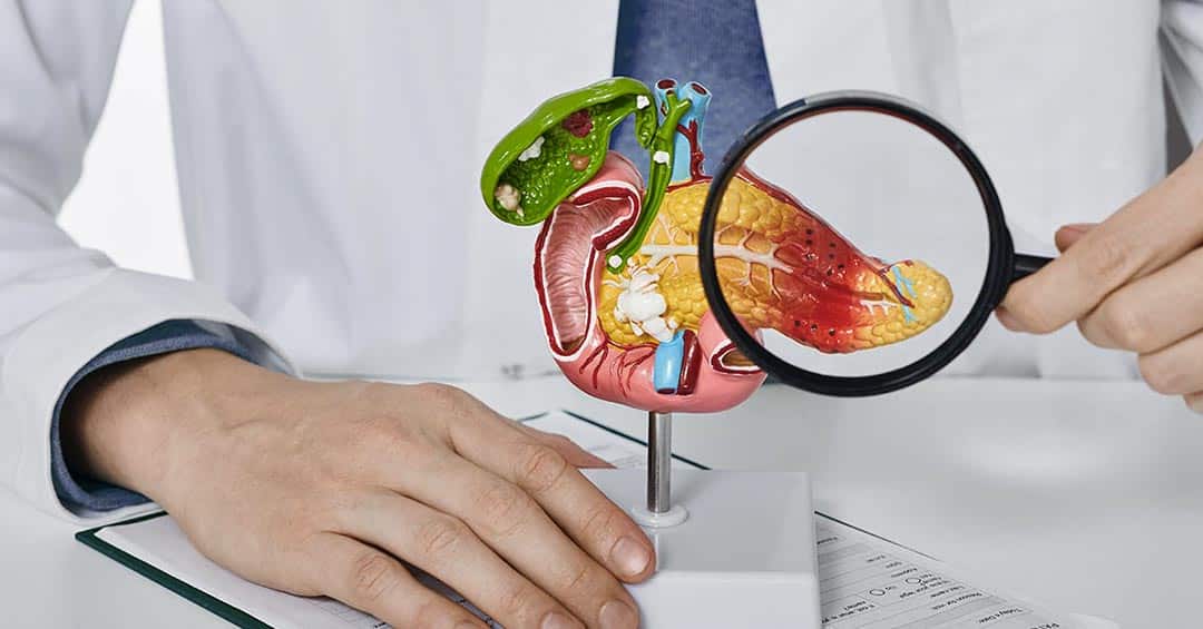 Cancer du pancréas : ces 10 signaux d’alerte que votre corps vous envoie (et qu’il ne faut pas négliger)