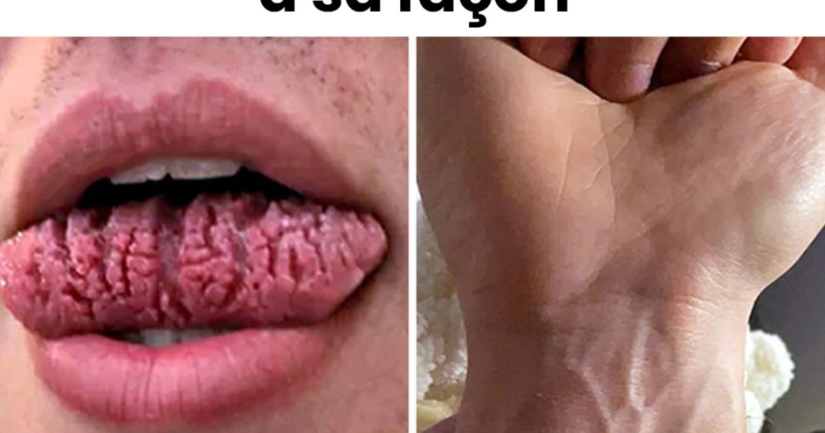 18 personnes dont la génétique a pris un chemin différent