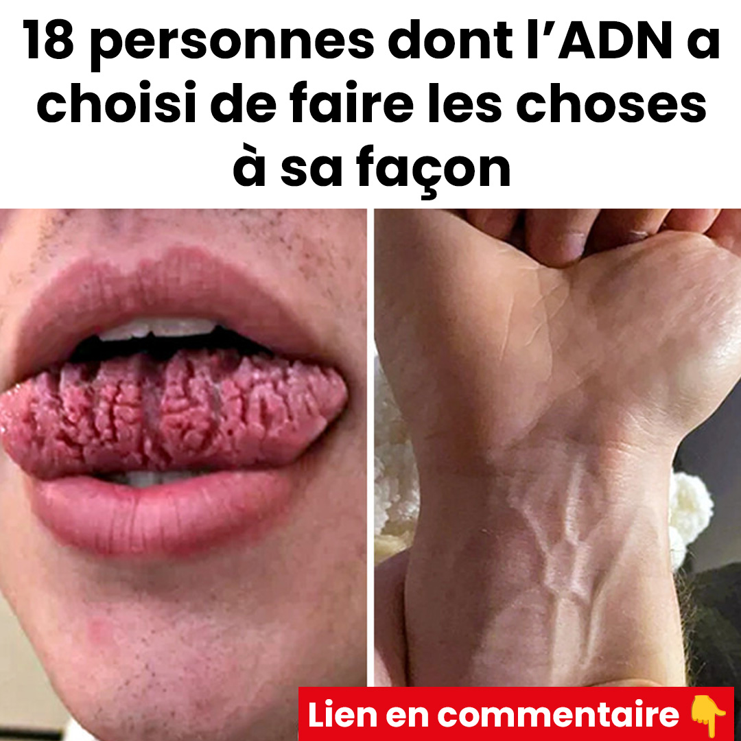 18 personnes dont la génétique a pris un chemin différent