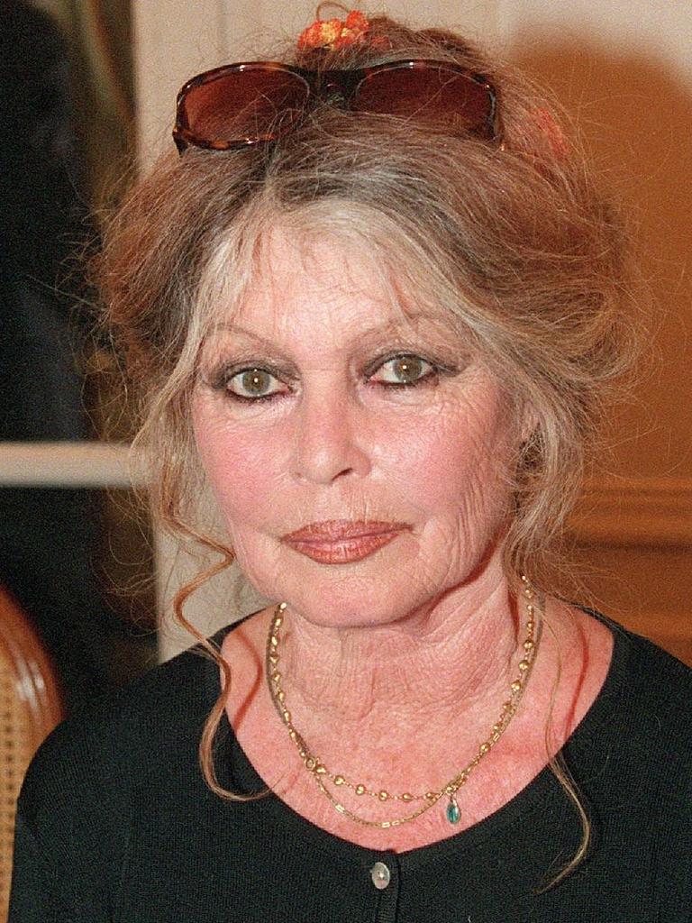 Elle n’a jamais eu recours à la chirurgie esthétique : cette photo de Brigitte Bardot, sans aucun filtre, va vous couper le souffle