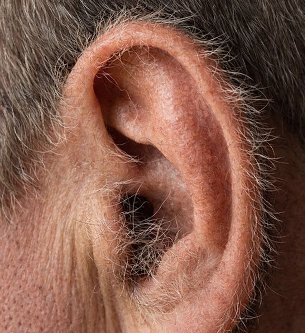 Poils d’oreilles : ce que votre corps vous dit silencieusement