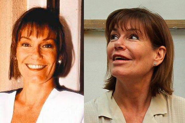 Quand la beauté devient une obsession : ces visages célèbres que la chirurgie a défigurés