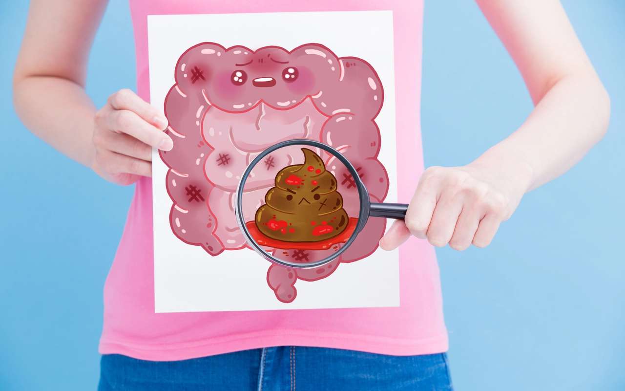 Ces 5 signaux d’alerte du cancer colorectal que vous ne devez surtout pas négliger