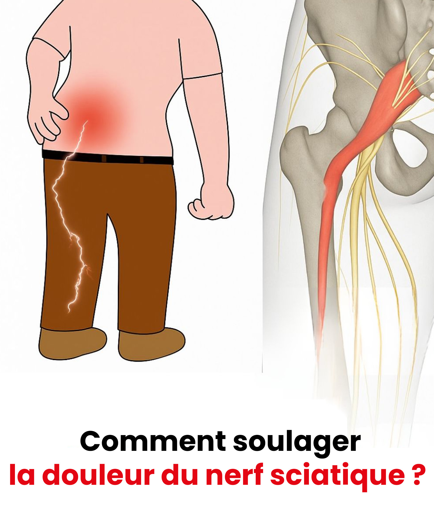 3 exercices pour soulager la douleur du nerf sciatique