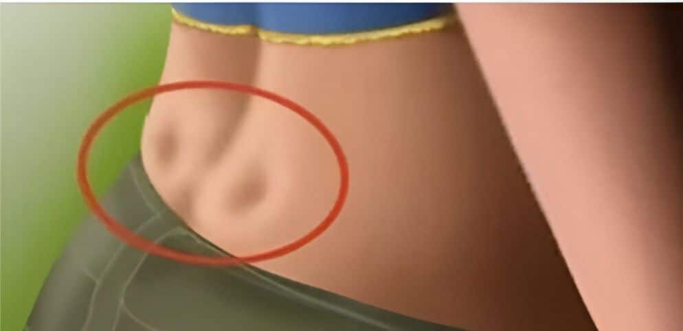 Ces petites fossettes au bas du dos : que révèlent-elles vraiment sur votre corps ?