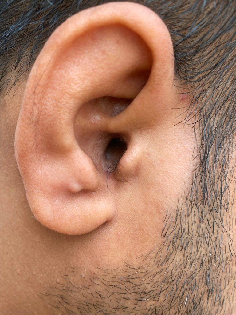 Poils d’oreilles : ce que votre corps vous dit silencieusement