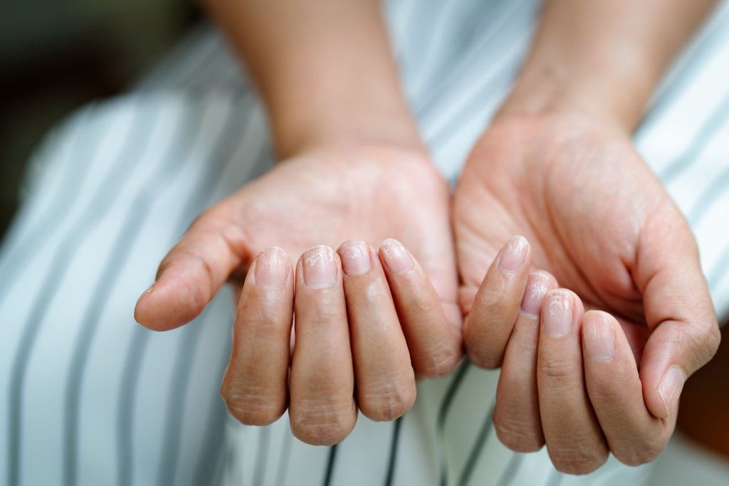 Vos ongles se brisent ? Ce signal discret que votre santé vous envoie