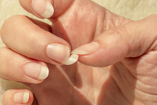 Ongles qui se fendent ou se dédoublent ? Décryptez le signal d'alarme que vous envoie votre organisme