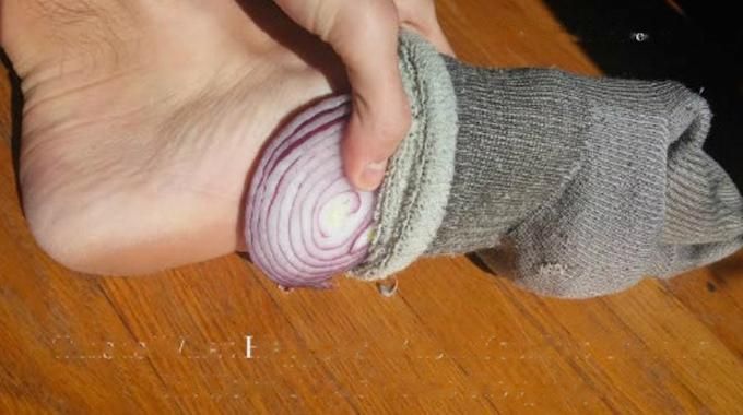 Nez bouché, toux nocturne : et si la solution se cachait dans une chaussette avec un simple oignon rouge ?