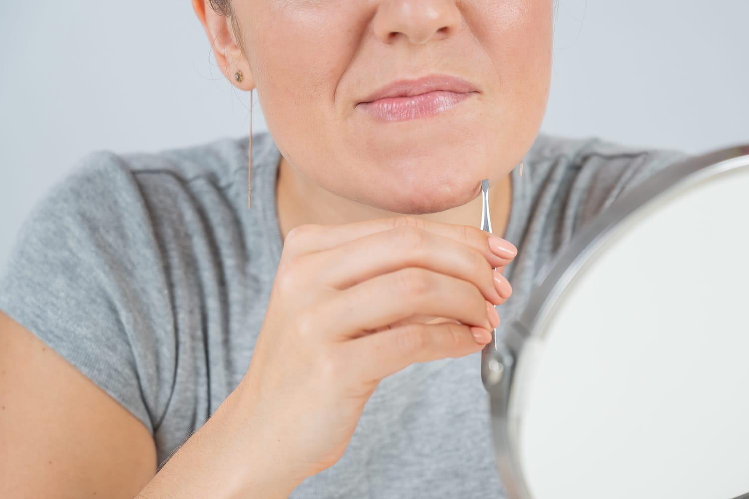 Poils au menton chez la femme : mythes, causes réelles et solutions pour s’en libérer