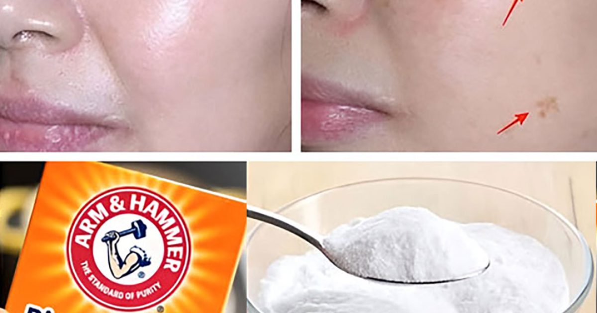 4 façons d’utiliser le bicarbonate de soude pour effacer les taches de vieillesse et retrouver une peau plus jeune et uniforme