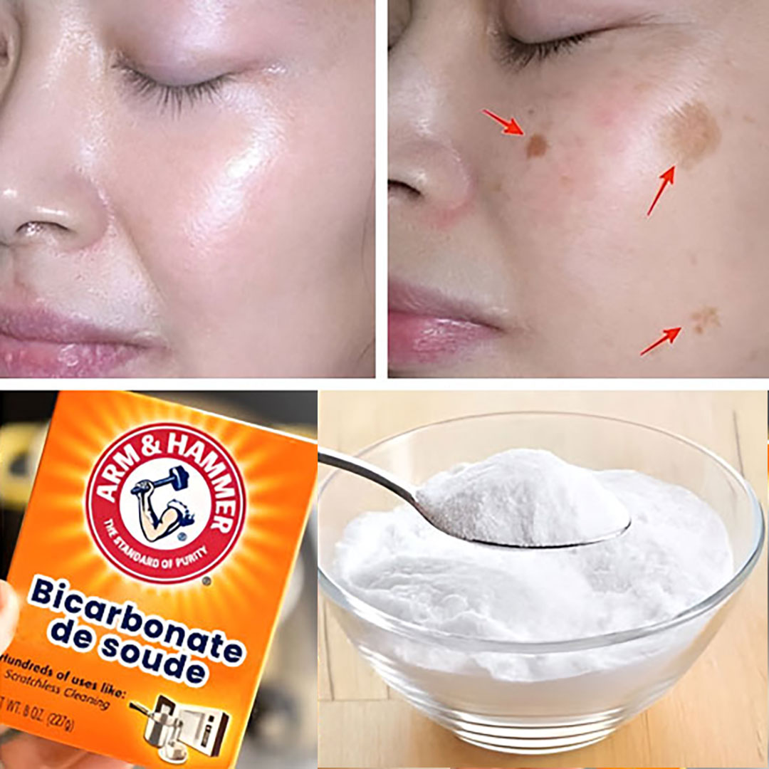 4 façons d’utiliser le bicarbonate de soude pour effacer les taches de vieillesse et retrouver une peau plus jeune et uniforme
