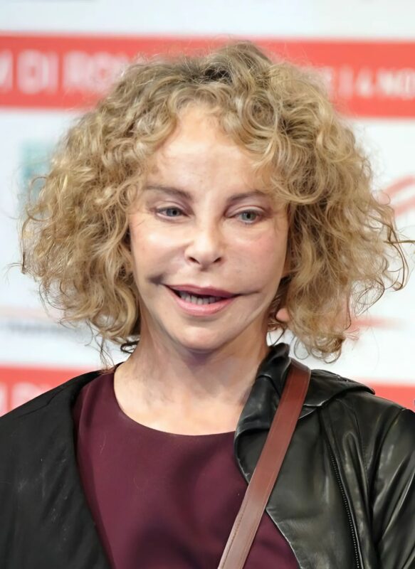Adorée du public pour son physique singulier, elle a radicalement métamorphosé son visage — et les images récentes laissent sans voix