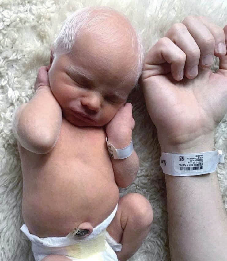 Des cheveux blancs à la une : ce bébé autrefois moqué est devenu un rayon de soleil épanoui