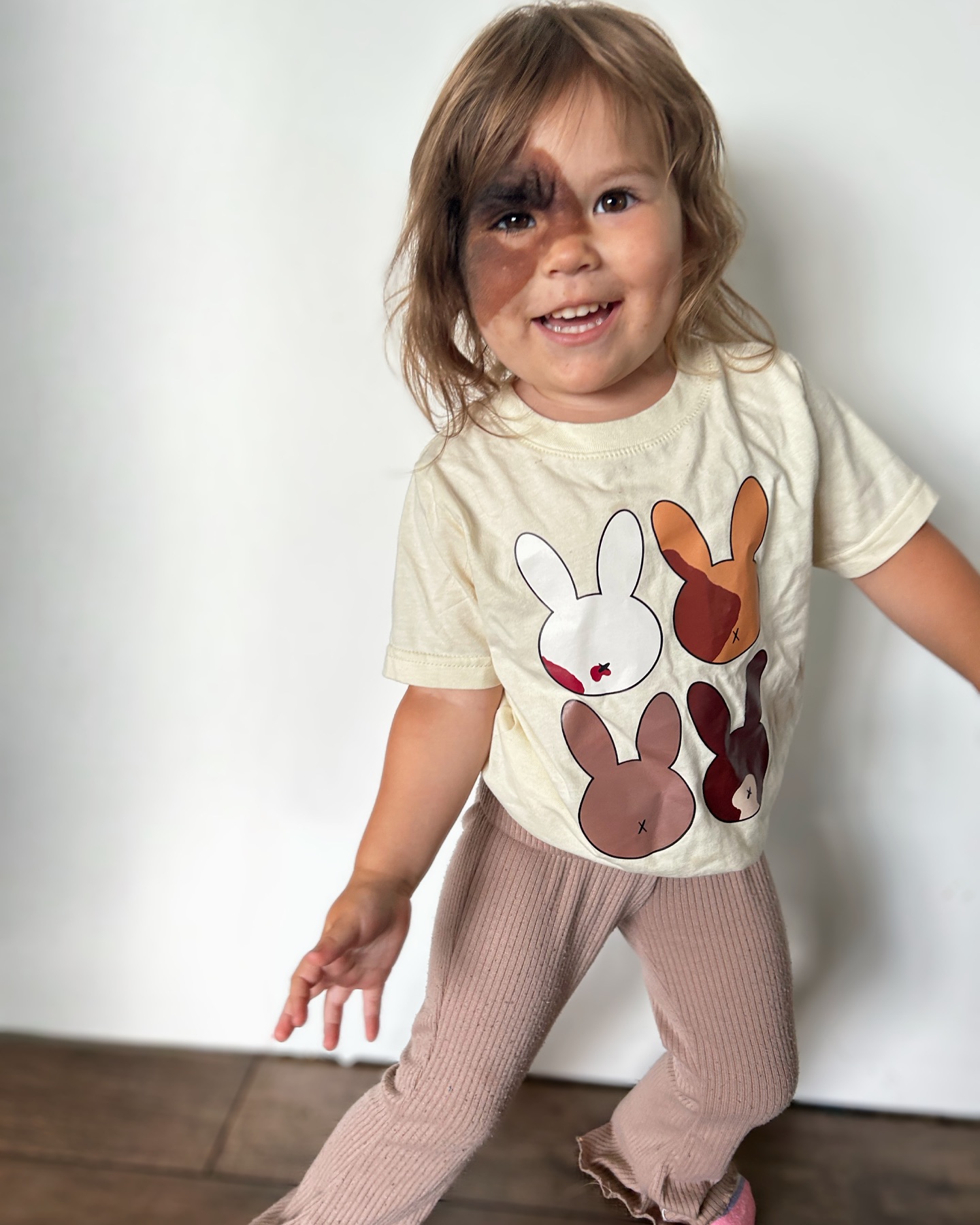 À sa naissance, une tache singulière a stupéfié ses parents : découvrez la petite fille qu’elle est devenue