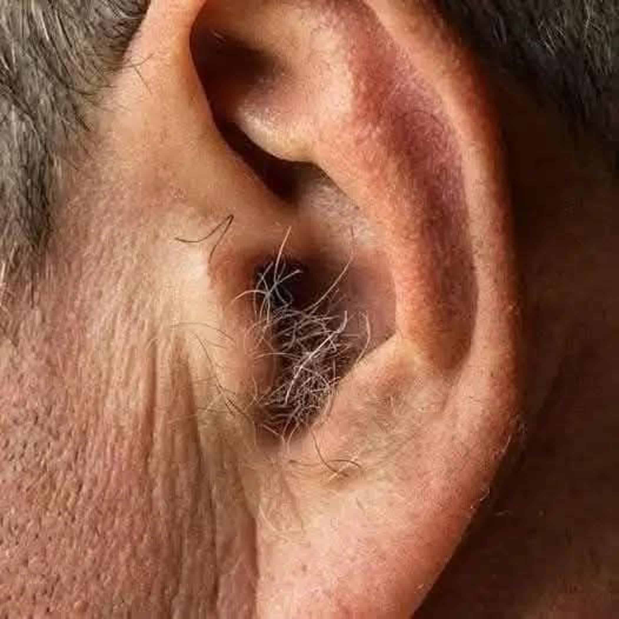 Illustration de poils d'oreille