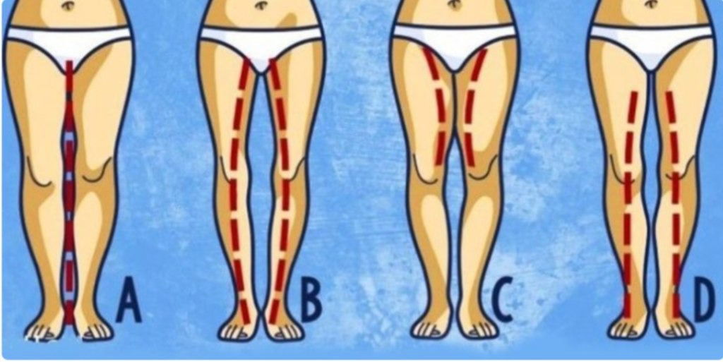 L’écart entre les cuisses : ce que votre morphologie raconte vraiment (et ce qu’elle ne dit pas)