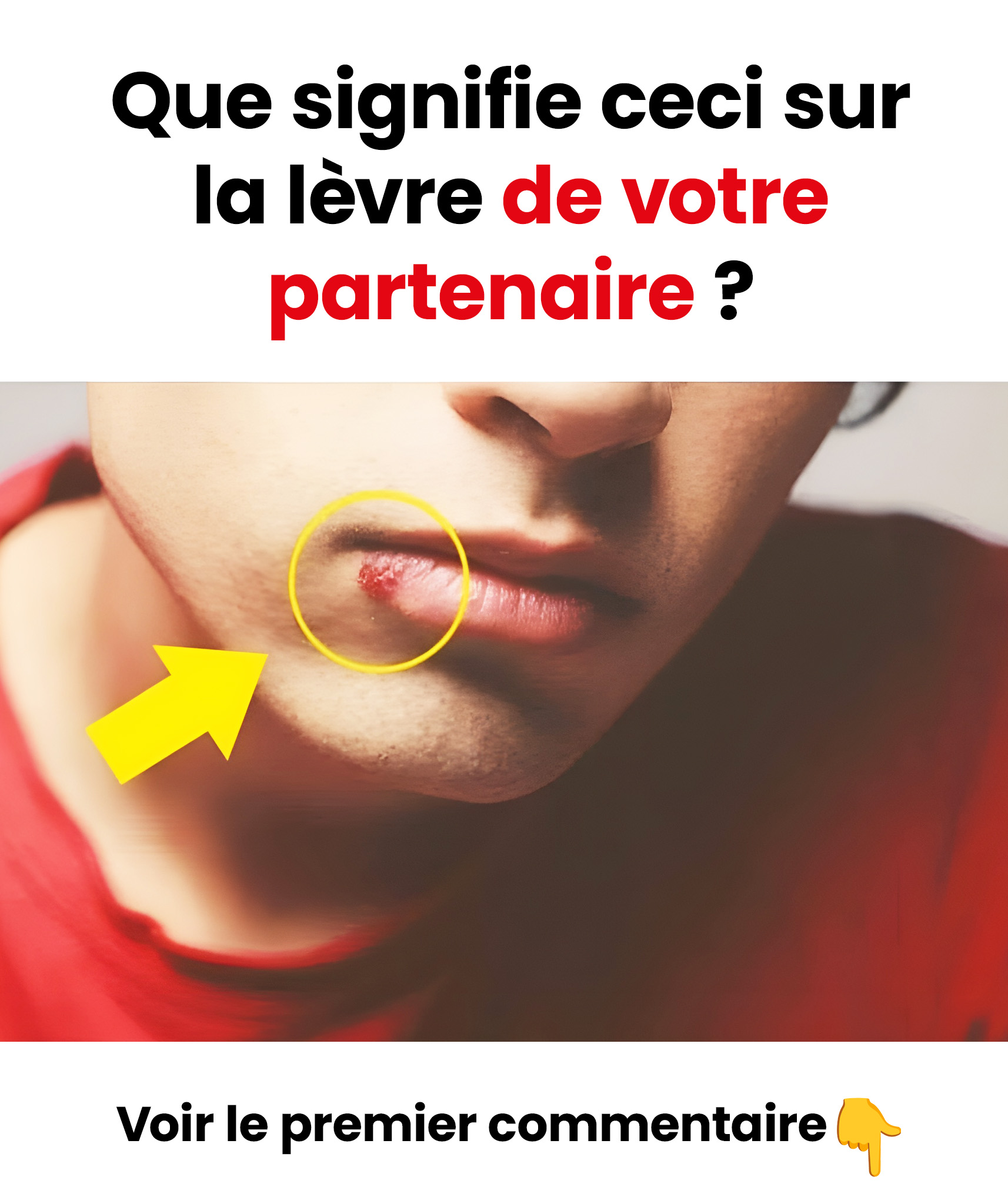 5 remèdes maison pour traiter les aphtes
