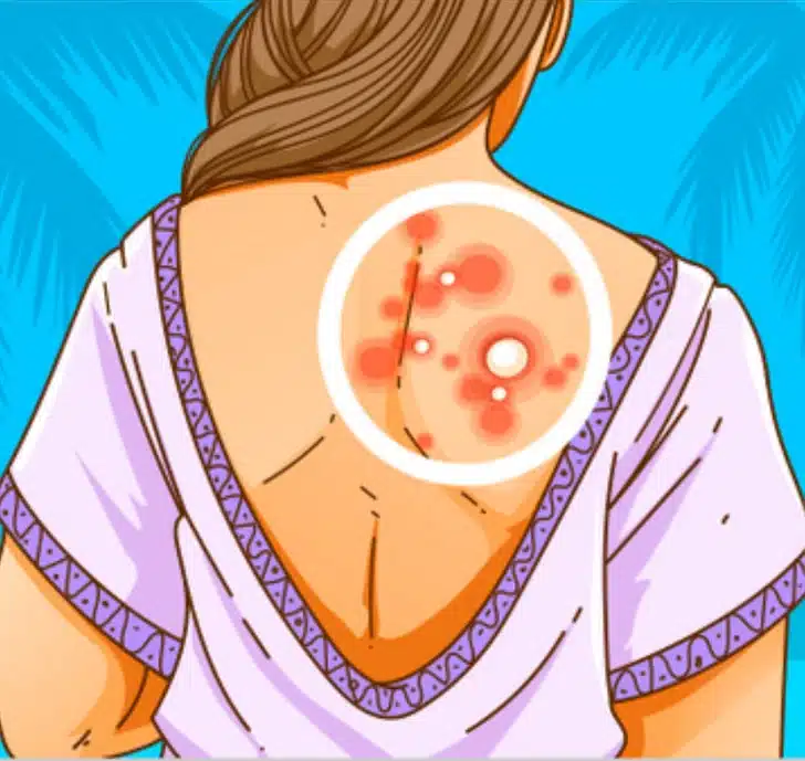 Illustration d'une peau fatiguée