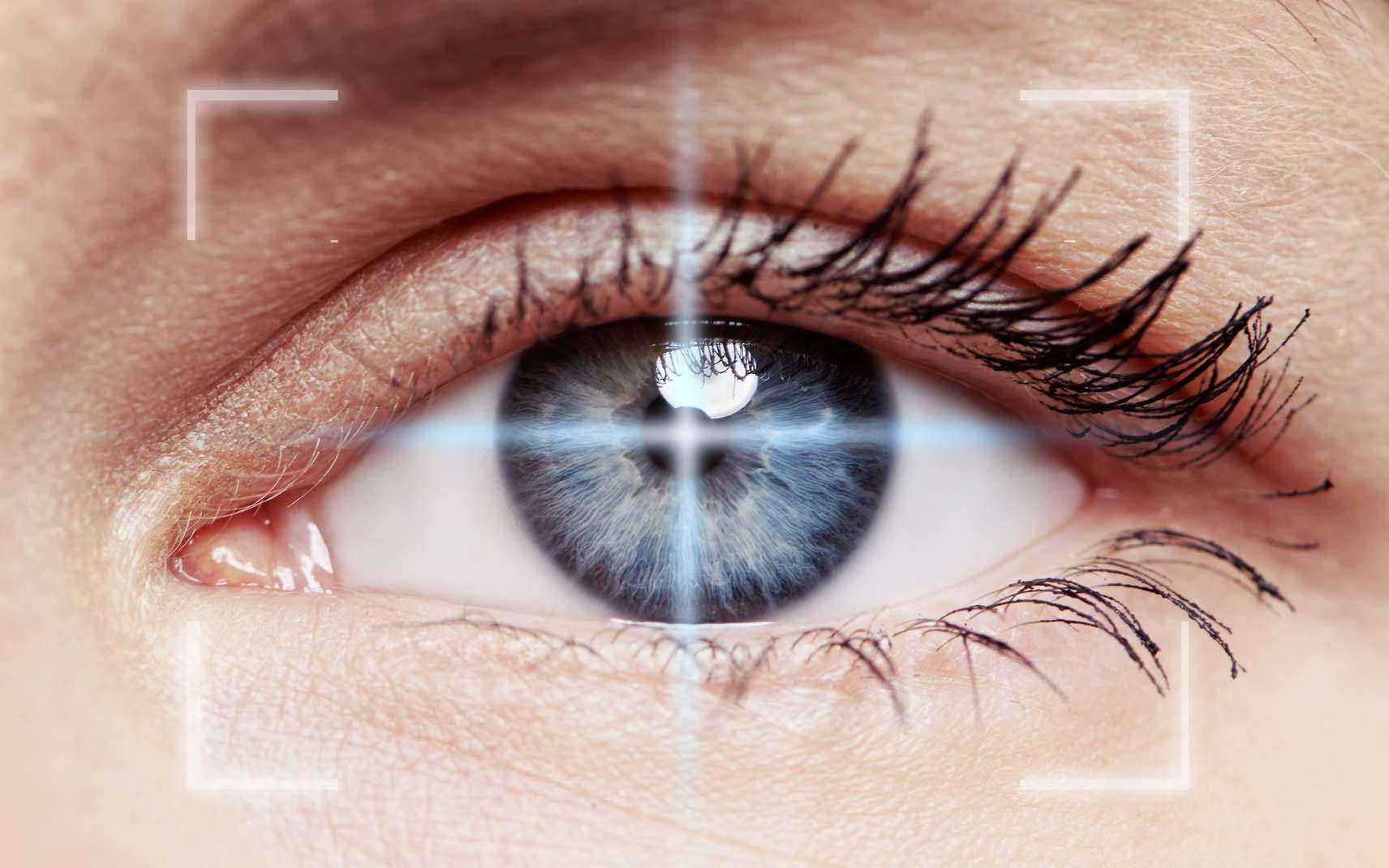 Mouches volantes dans les yeux : ces points noirs qui flottent dans votre vision et ce qu’il faut faire quand ils apparaissent