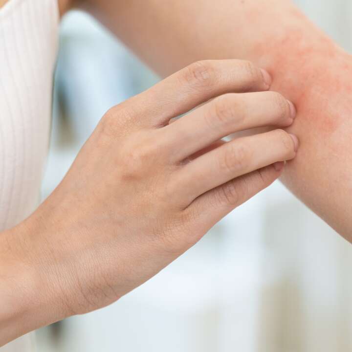 Réaction allergique cutanée
