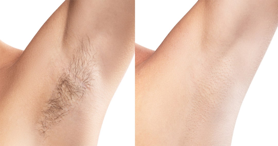 Application d'un soin naturel sur les jambes