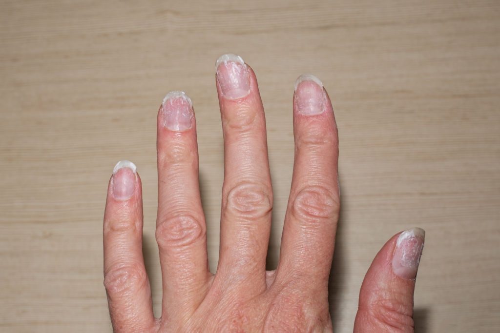 Vos ongles se brisent ? Ce signal discret que votre santé vous envoie