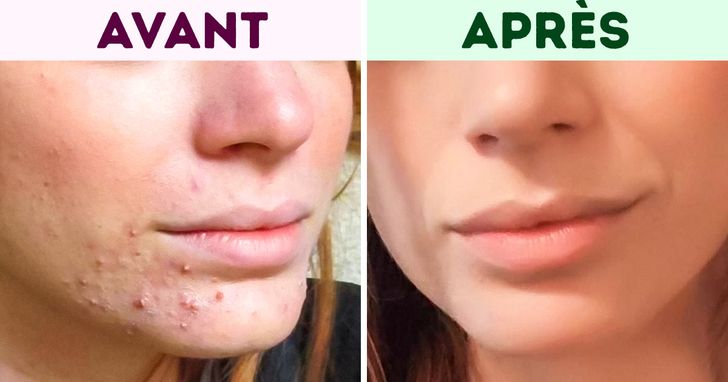 Retrouvez une peau lumineuse et sans taches : 4 astuces simples au bicarbonate de soude pour dire adieu aux marques de l’âge