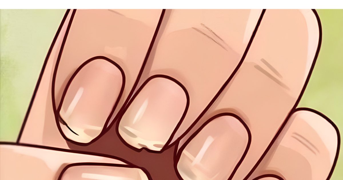 7 signaux discrets visibles sur vos ongles qui peuvent en dire long sur votre santé