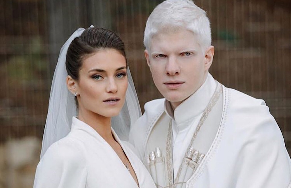 Le fils du plus bel albinos et d’un top model dévoile un charme qui électrise les réseaux sociaux