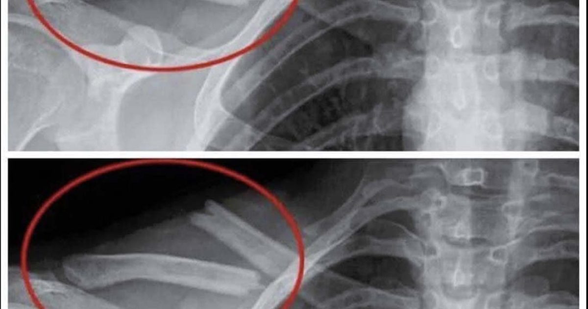 8 effets surprenants sur votre corps lorsque vous cessez de boire du soda light