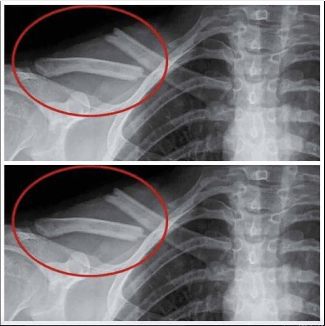 8 effets surprenants sur votre corps lorsque vous cessez de boire du soda light