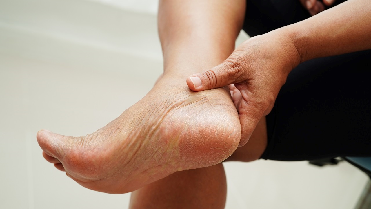 Ces 9 changements sur vos pieds que votre foie n’arrive plus à vous cacher