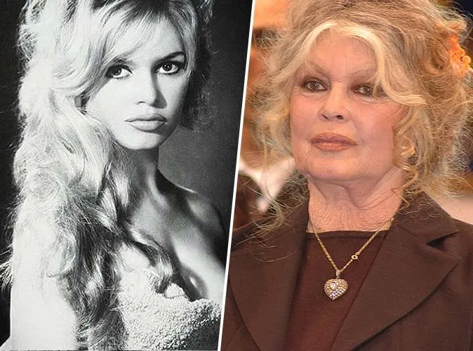 De Brigitte Bardot à Mickey Rourke : quand le temps transforme les visages des icônes