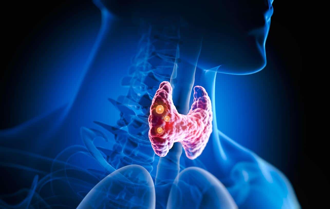 Représentation graphique de la thyroïde