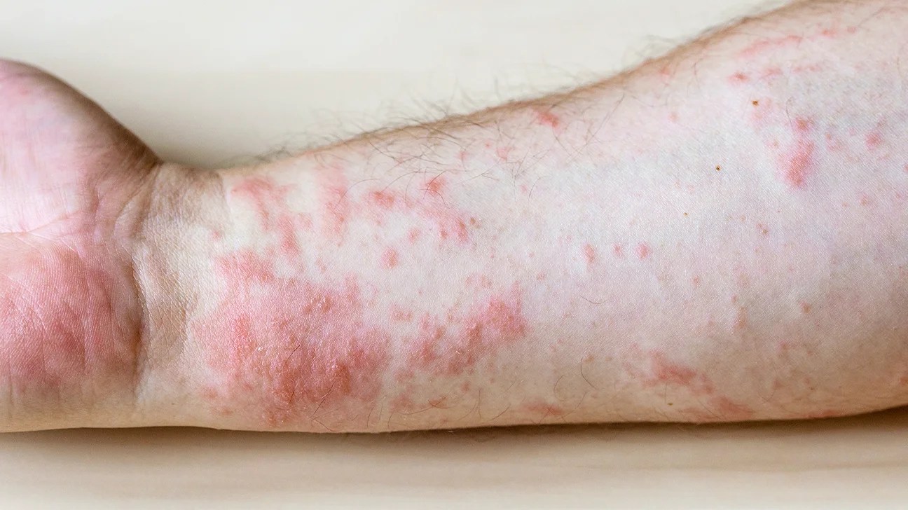 Vos reins tirent la sonnette d’alarme : ces 8 indices corporels à ne surtout pas négliger