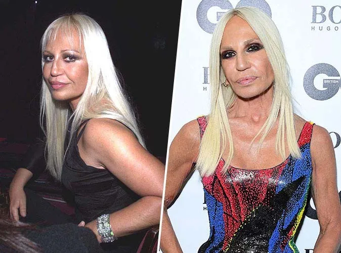 De Brigitte Bardot à Mickey Rourke : quand le temps transforme les visages des icônes