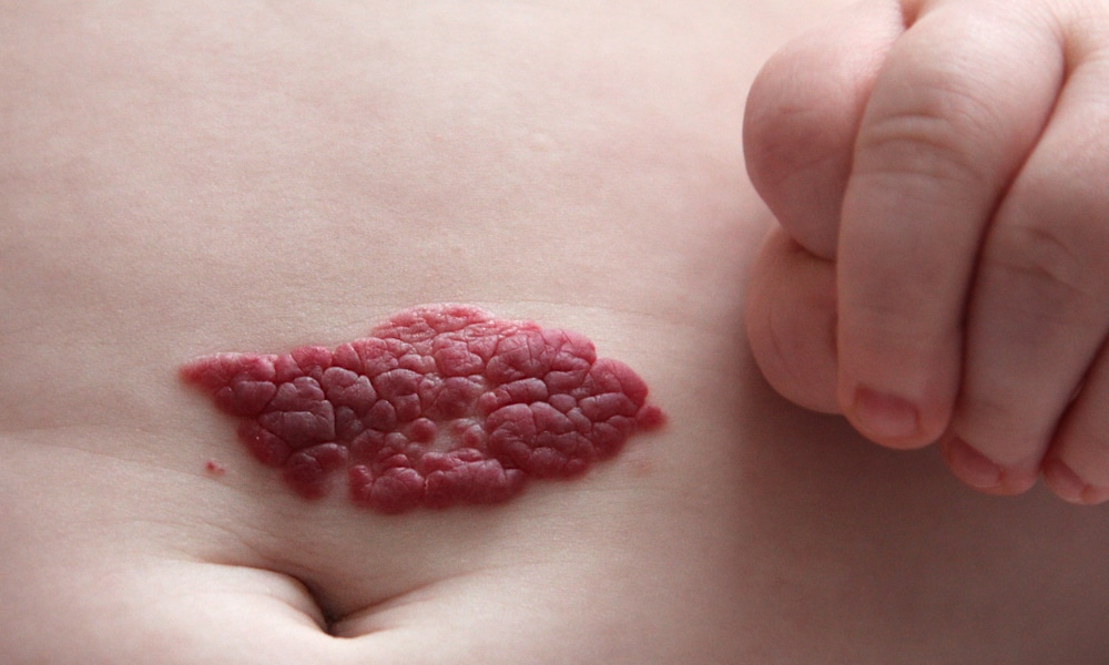 Petits points rouges sur la peau : ce que votre corps essaie vraiment de vous dire