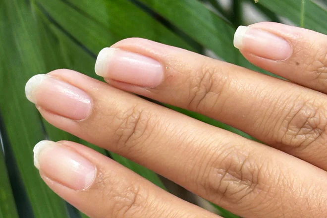 Stries sur les ongles : ce que ces fines lignes révèlent vraiment sur votre santé