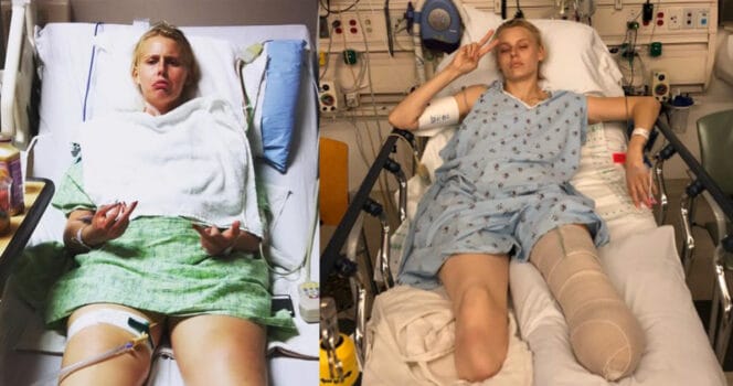 Un geste anodin du quotidien lui a coûté ses deux jambes : l’incroyable combat de Lauren Wasser