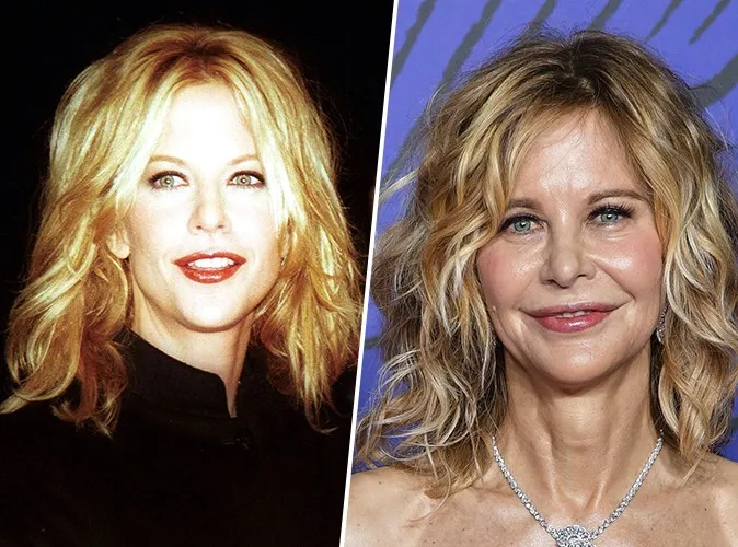 De Brigitte Bardot à Mickey Rourke : quand le temps transforme les visages des icônes