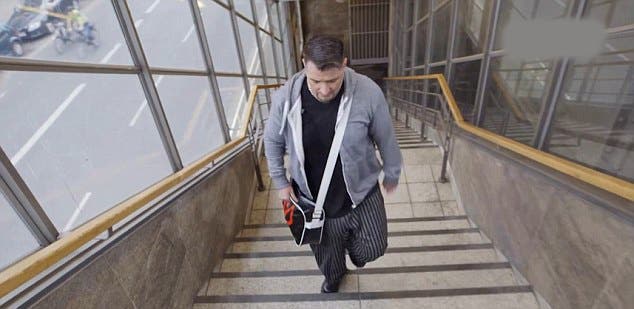 Quand la chirurgie esthétique transforme le sexe en calvaire : l’histoire de Micha Stunz