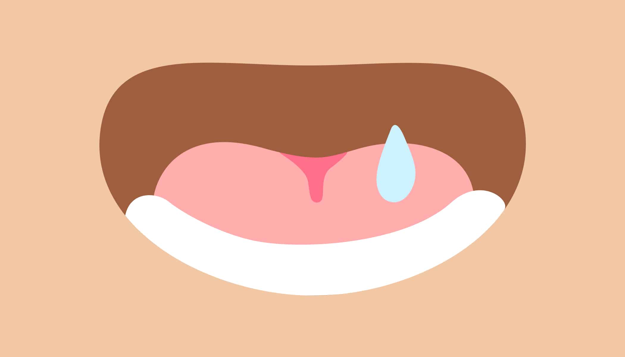 bouche sèche