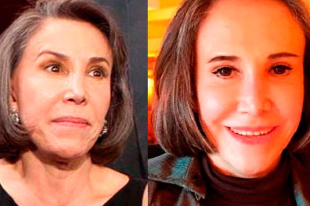 Quand la beauté devient une obsession : ces visages célèbres que la chirurgie a défigurés