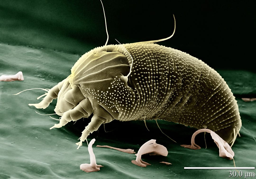 Microphotographie d'acariens