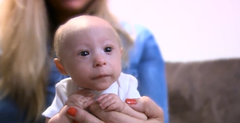 À 7 mois, il porte encore du 0-3 mois : le parcours de Mathieu, bébé pas comme les autres, émeut et inspire
