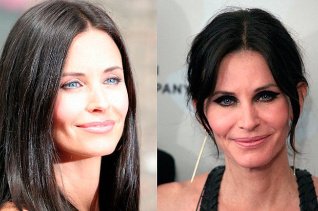Quand la beauté devient une obsession : ces visages célèbres que la chirurgie a défigurés