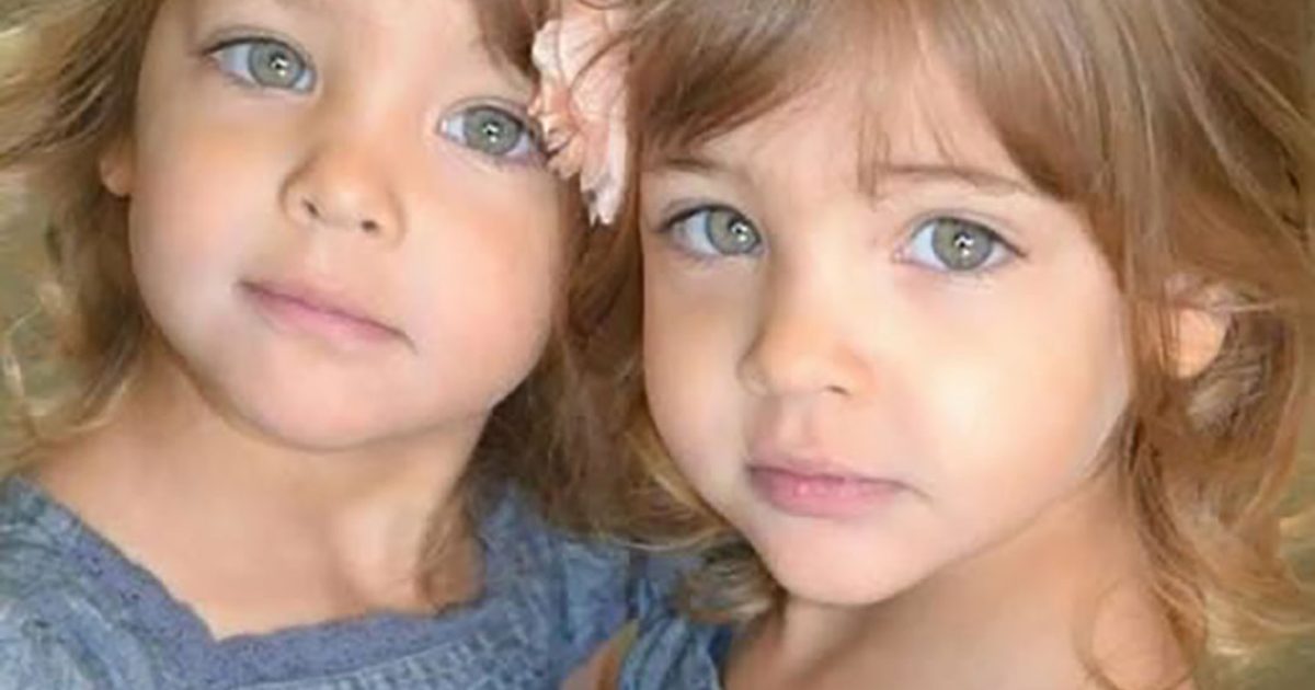 À 7 ans, elles étaient considérées comme les plus belles jumelles du monde. Découvrez à quoi elles ressemblent aujourd’hui