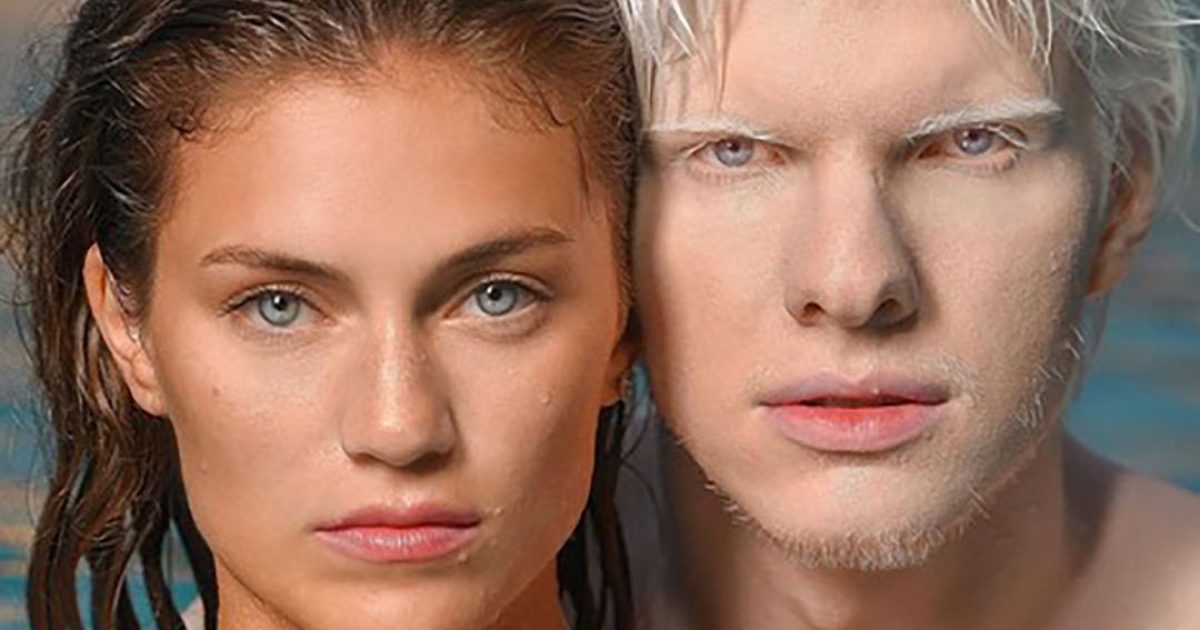 À quoi ressemble le fils du plus bel albinos et d’un mannequin ? Un enfant à la beauté exceptionnelle