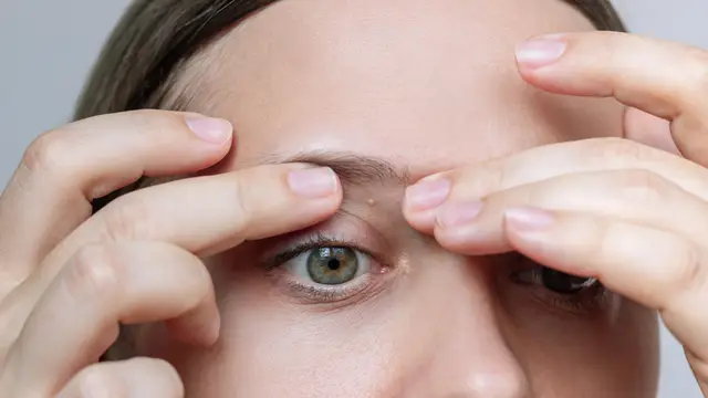 Petits points blancs sur la peau : ce qu’il faut savoir (et ne surtout pas faire) pour les éliminer sans risque